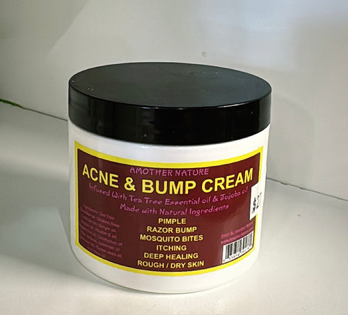 Acne & Bump cream