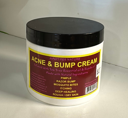 Acne & Bump cream